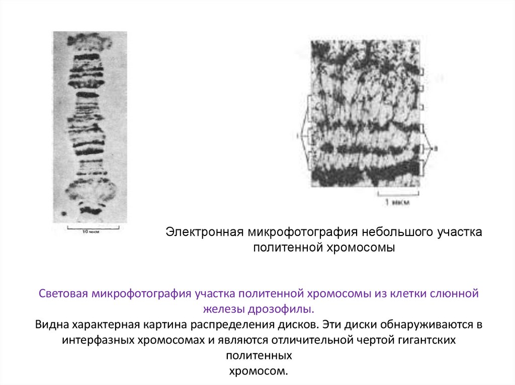 Световая микрофотография участка политенной хромосомы из клетки слюнной железы дрозофилы. Видна характерная картина