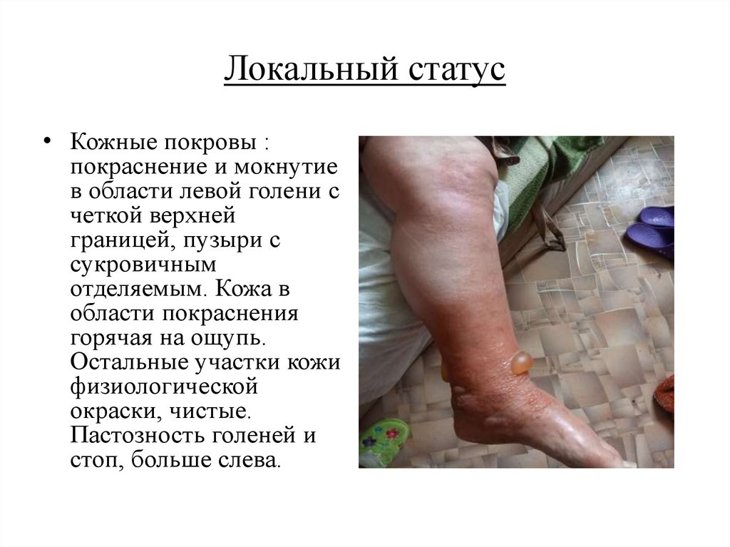 Локальный статус