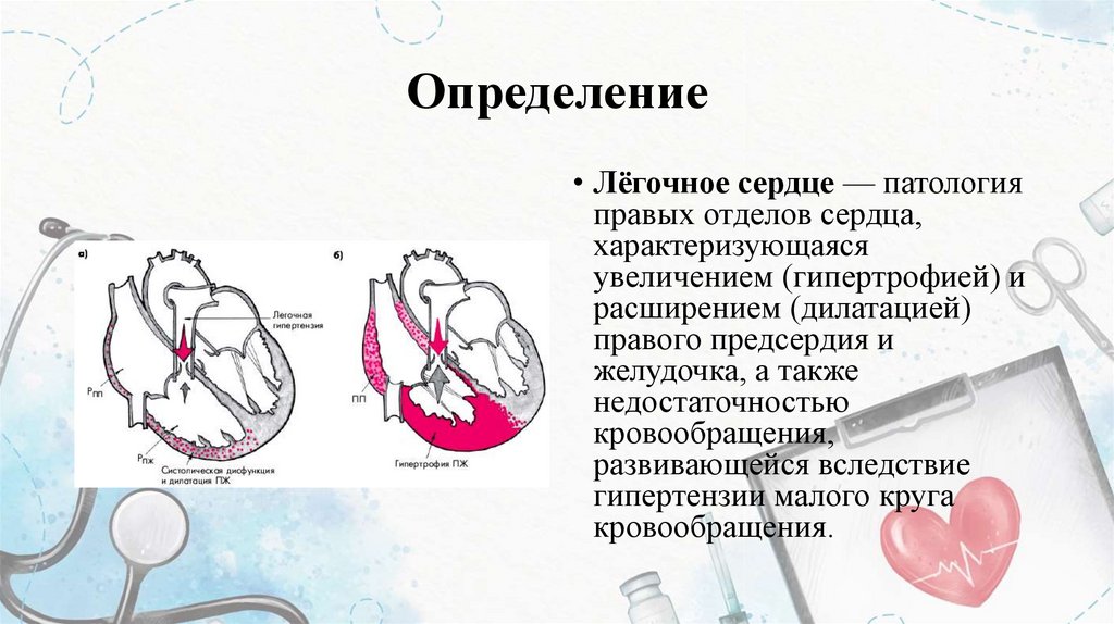 Определение