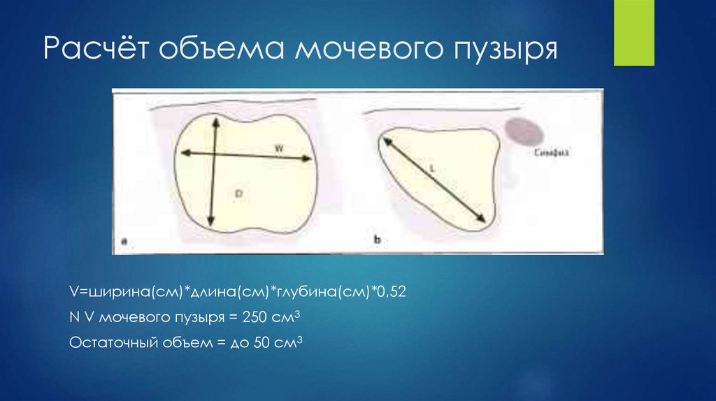 Расчёт объема мочевого пузыря