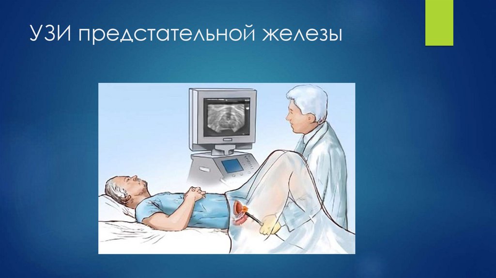 УЗИ предстательной железы