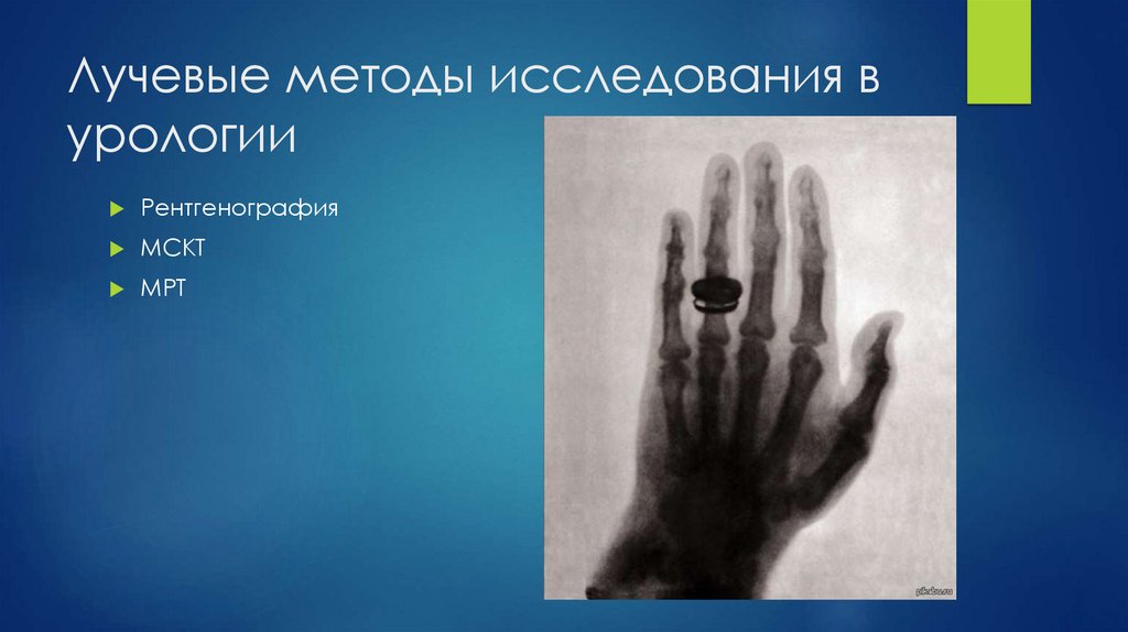 Лучевые методы исследования в урологии