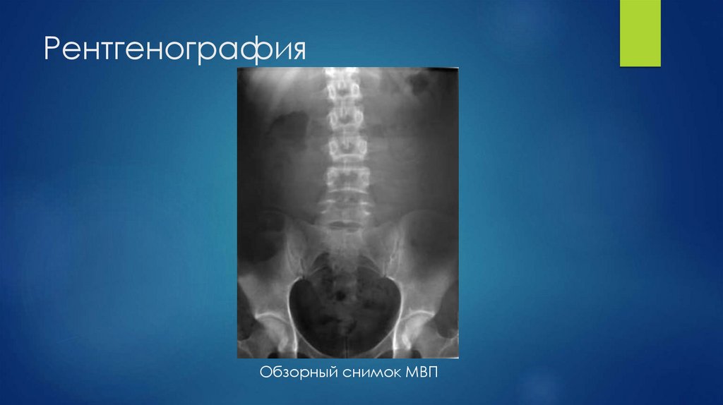Рентгенография