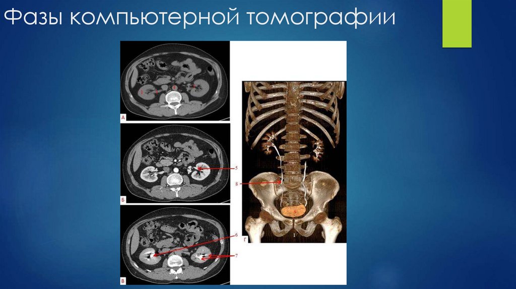 Фазы компьютерной томографии