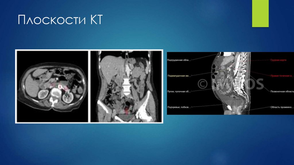 Плоскости КТ
