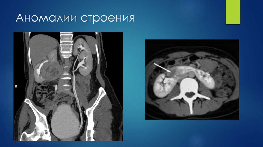 Аномалии строения