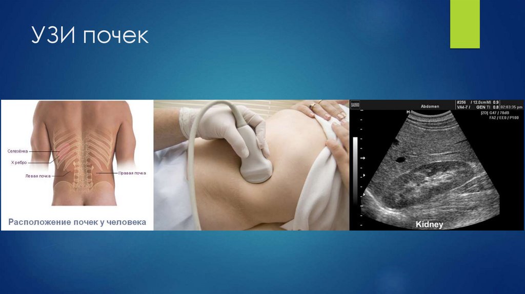 УЗИ почек