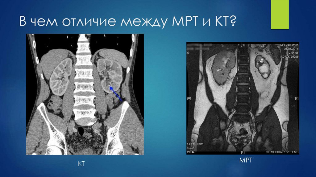 В чем отличие между МРТ и КТ?