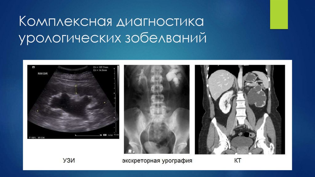 Комплексная диагностика урологических зобелваний