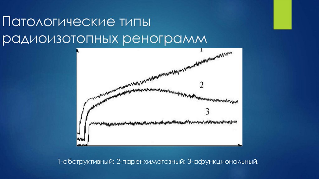Патологические типы радиоизотопных ренограмм