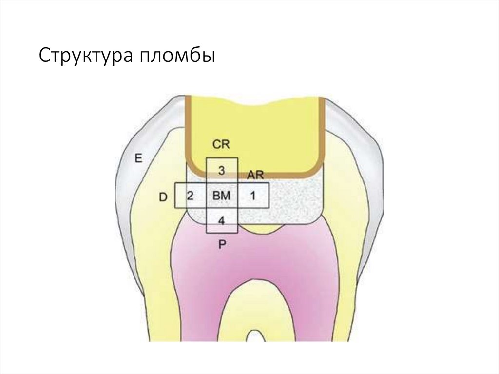 Структура пломбы