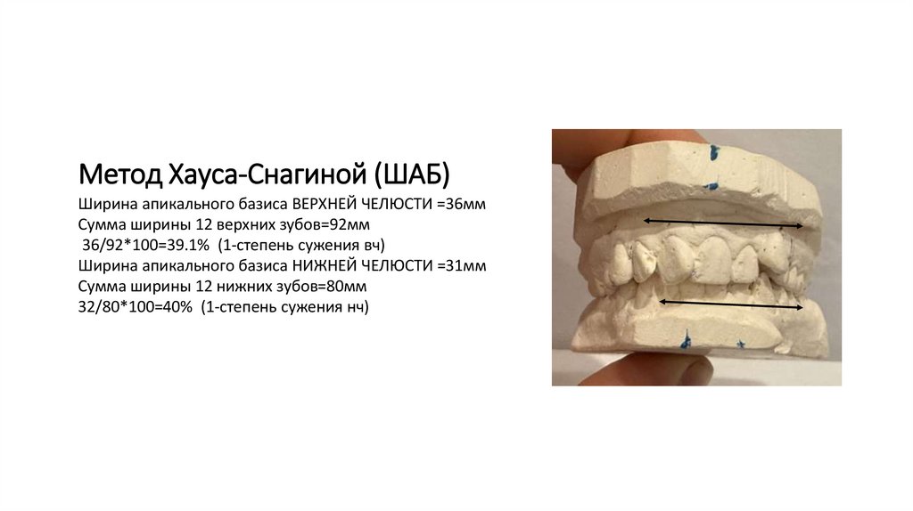 Метод Хауса-Снагиной (ШАБ)