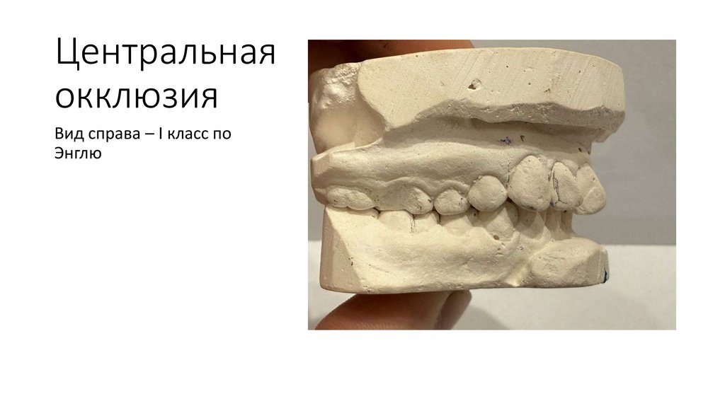 Центральная окклюзия