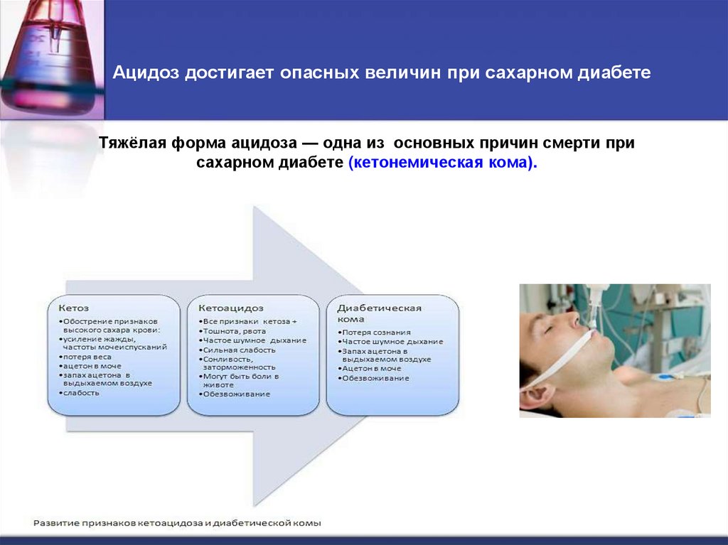 Ацидоз достигает опасных величин при сахарном диабете