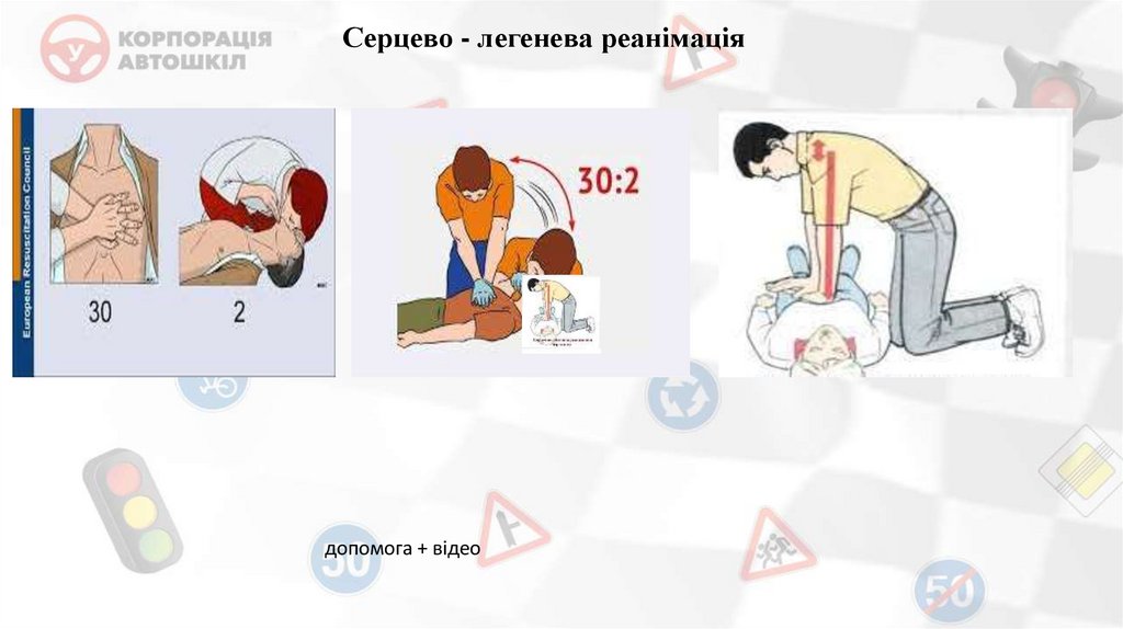 Серцево - легенева реанімація