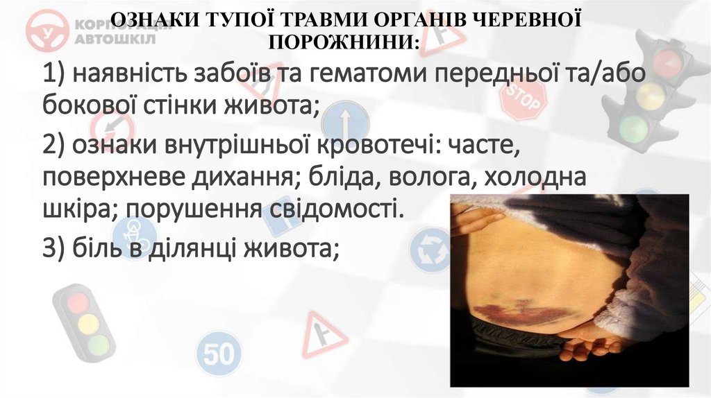 ОЗНАКИ ТУПОЇ ТРАВМИ ОРГАНІВ ЧЕРЕВНОЇ ПОРОЖНИНИ: