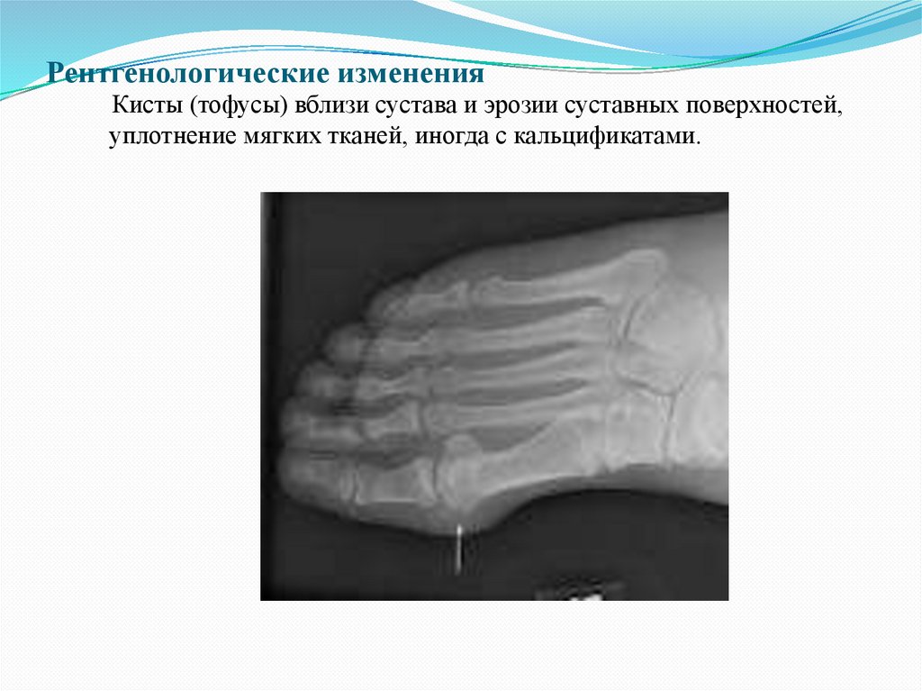 Рентгенологические изменения