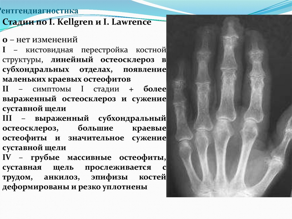 Рентгендиагностика