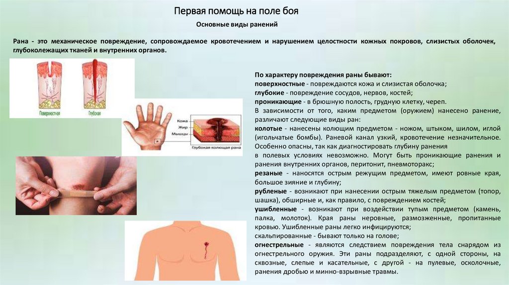 Первая помощь на поле боя