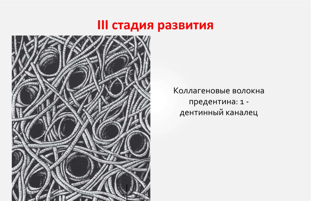 III стадия развития