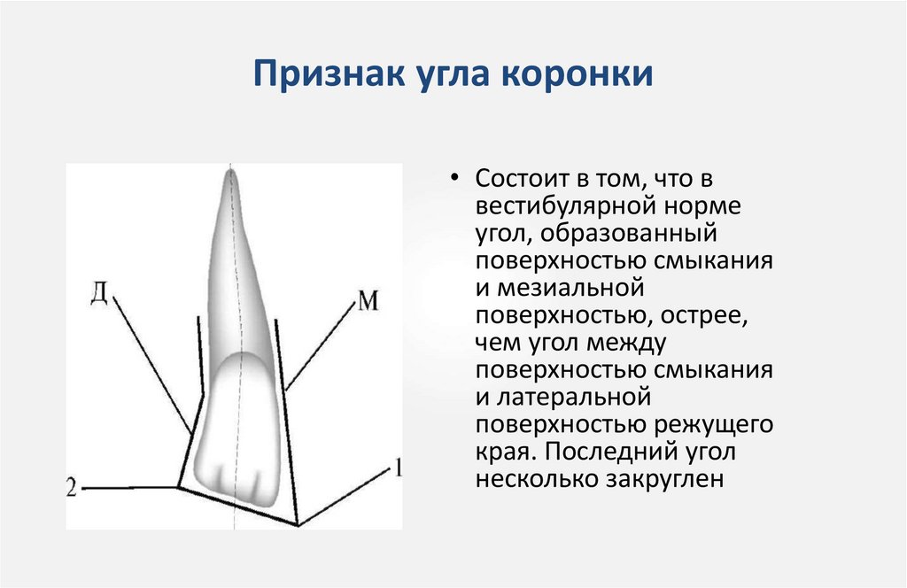 Признак угла коронки