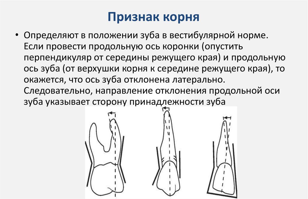 Признак корня