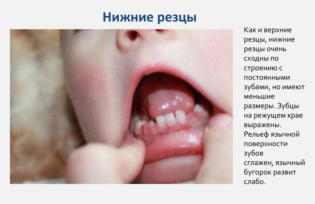 Нижние резцы