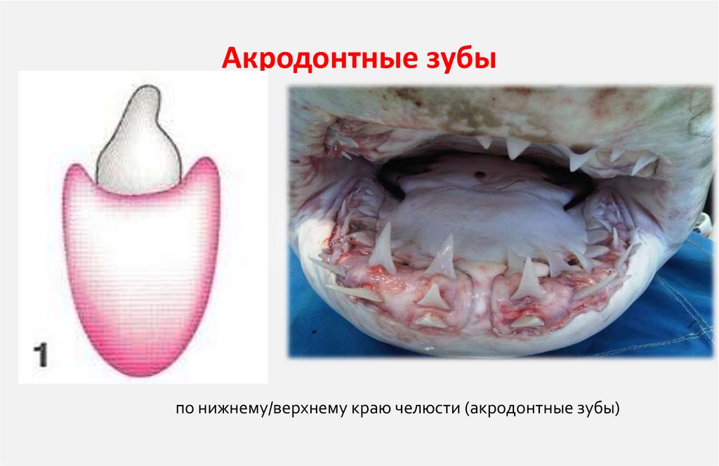 Акродонтные зубы