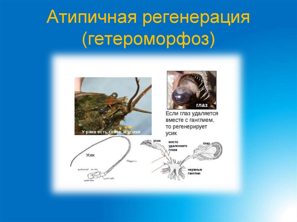 Атипичная регенерация (гетероморфоз)