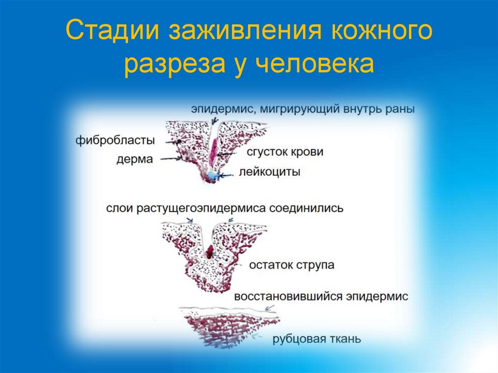Стадии заживления кожного разреза у человека