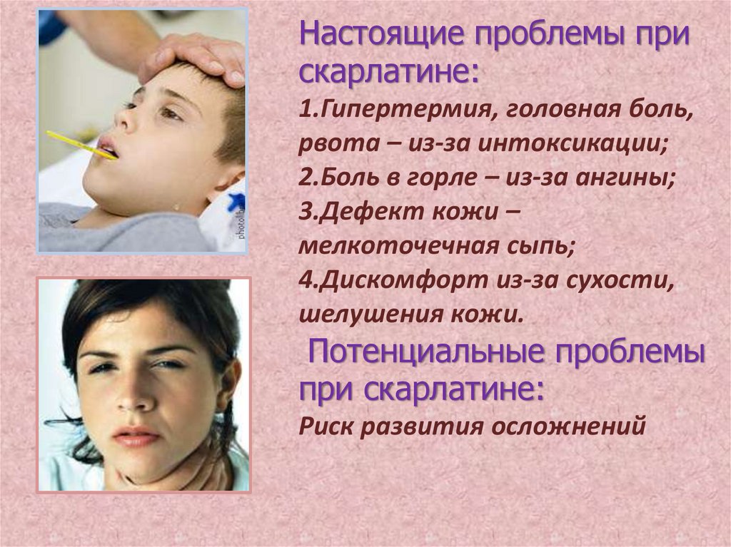 Настоящие проблемы при скарлатине: 1.Гипертермия, головная боль, рвота – из-за интоксикации; 2.Боль в горле – из-за ангины;