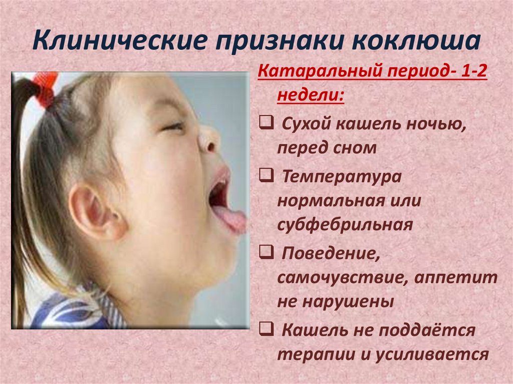 Клинические признаки коклюша