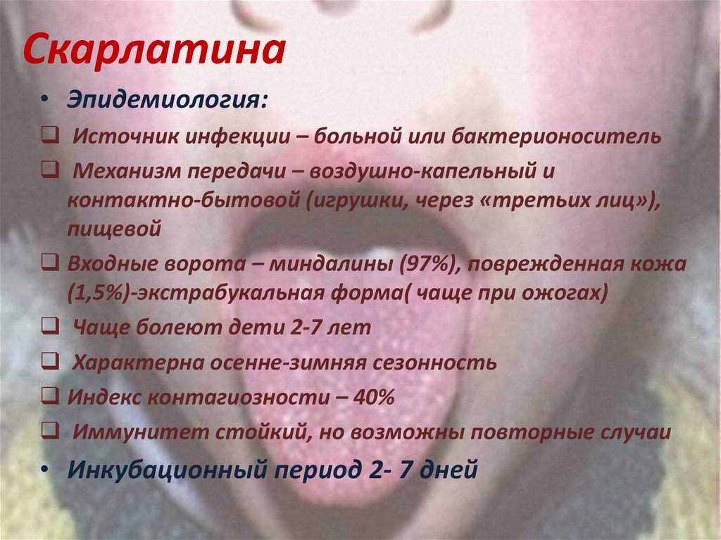 Скарлатина