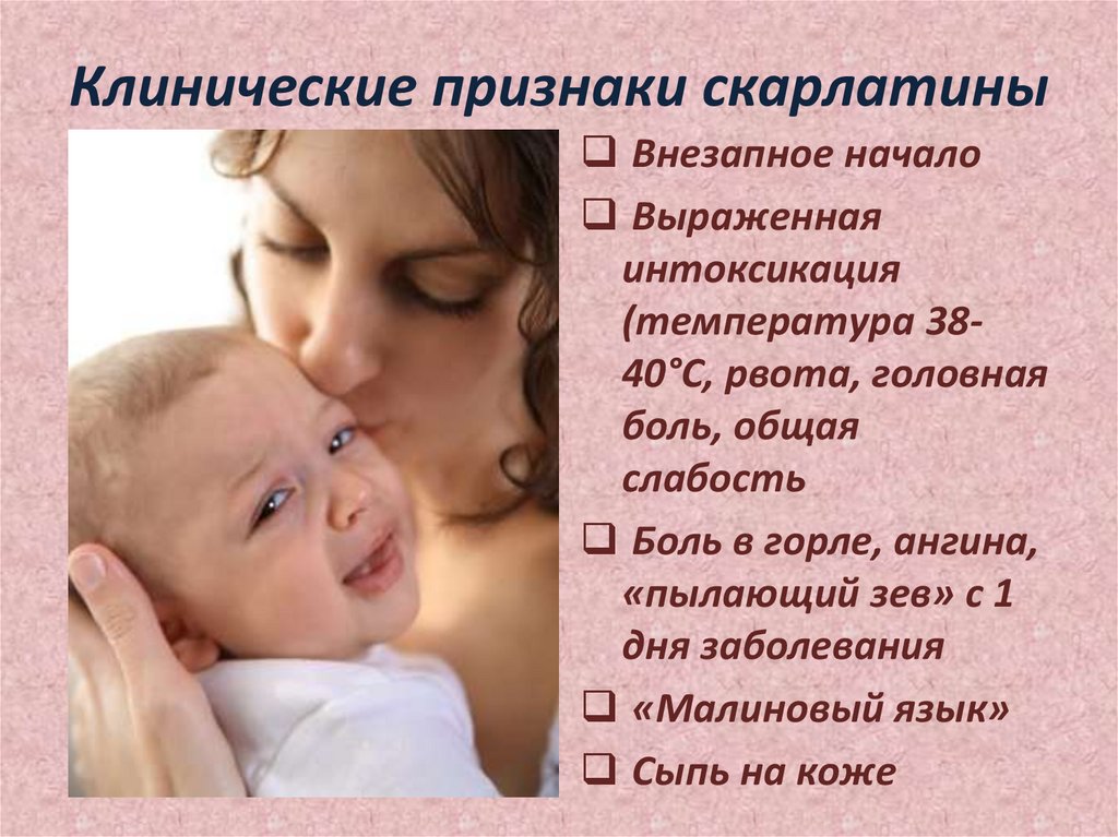 Клинические признаки скарлатины