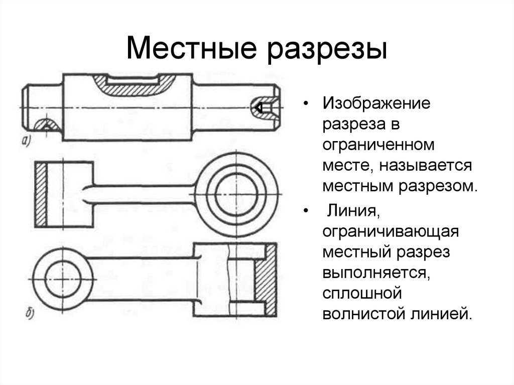 Местные разрезы