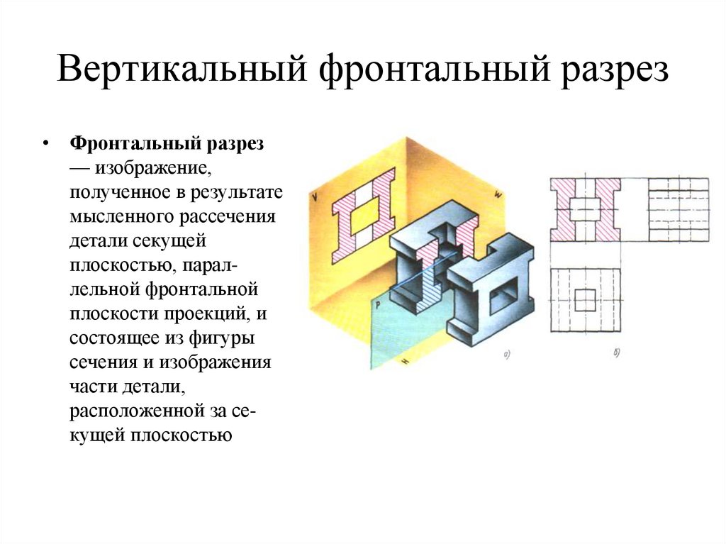 Вертикальный фронтальный разрез