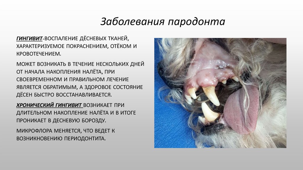 Заболевания пародонта