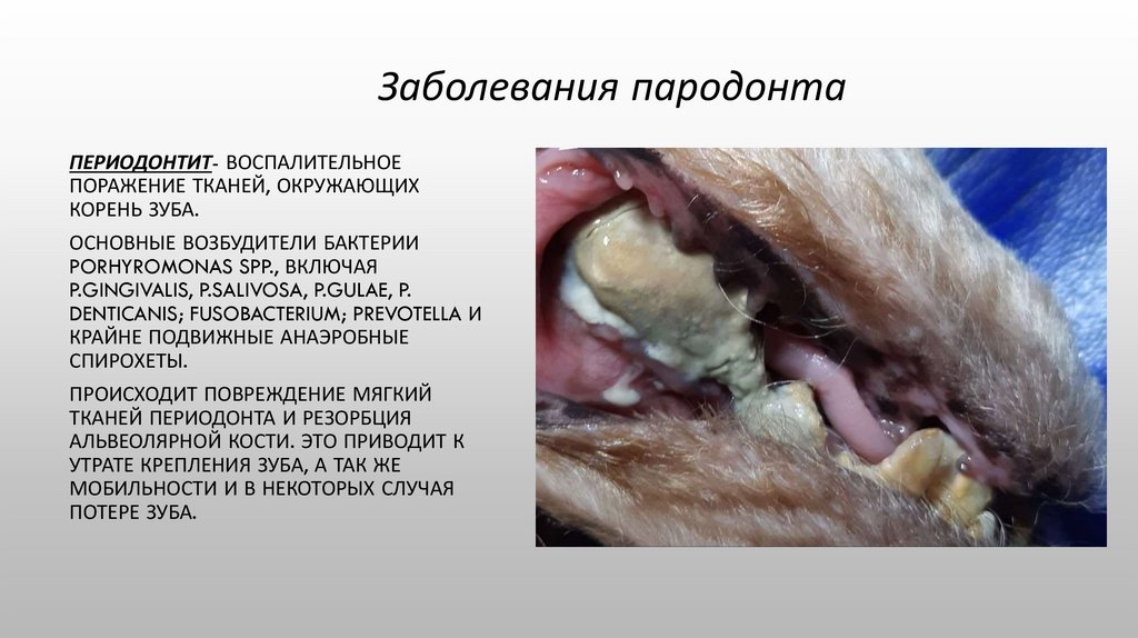 Заболевания пародонта