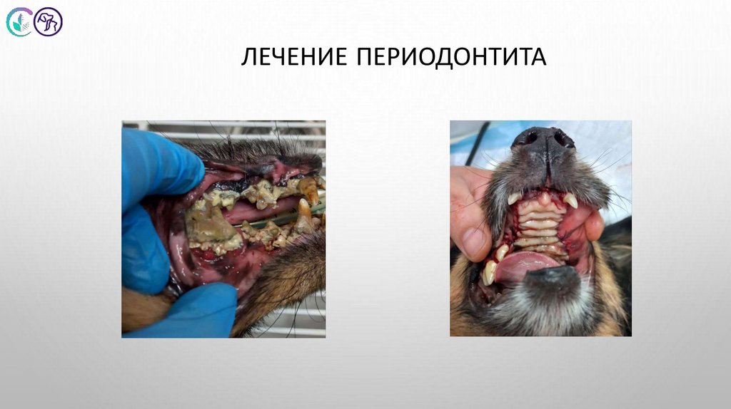 Лечение периодонтита