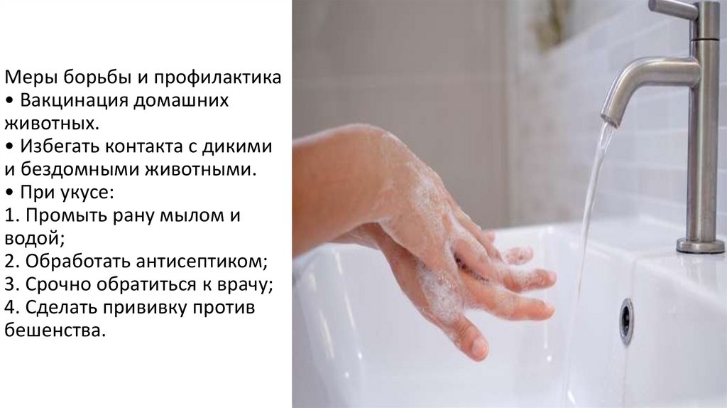 Меры борьбы и профилактика • Вакцинация домашних животных. • Избегать контакта с дикими и бездомными животными. • При укусе: 1.