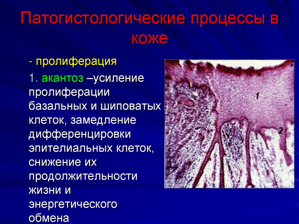 Патогистологические процессы в коже