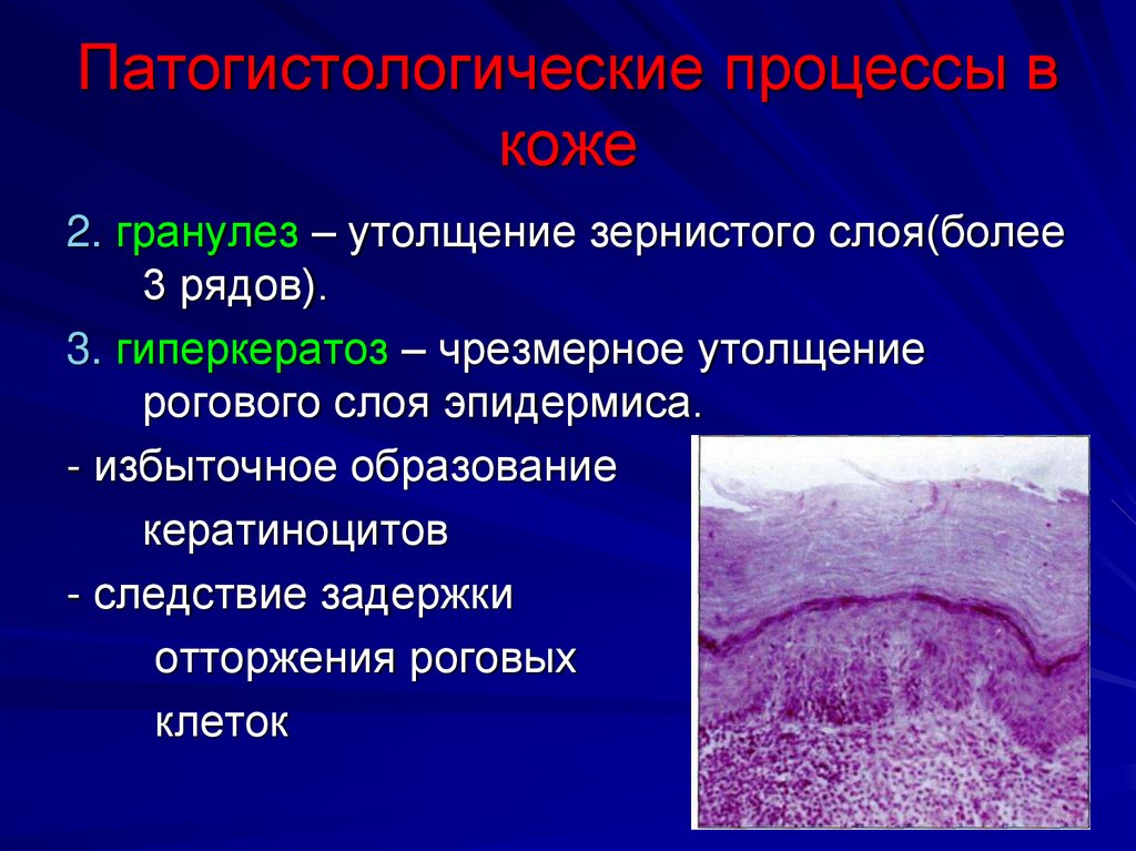 Патогистологические процессы в коже