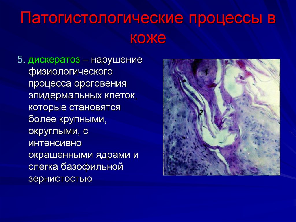Патогистологические процессы в коже