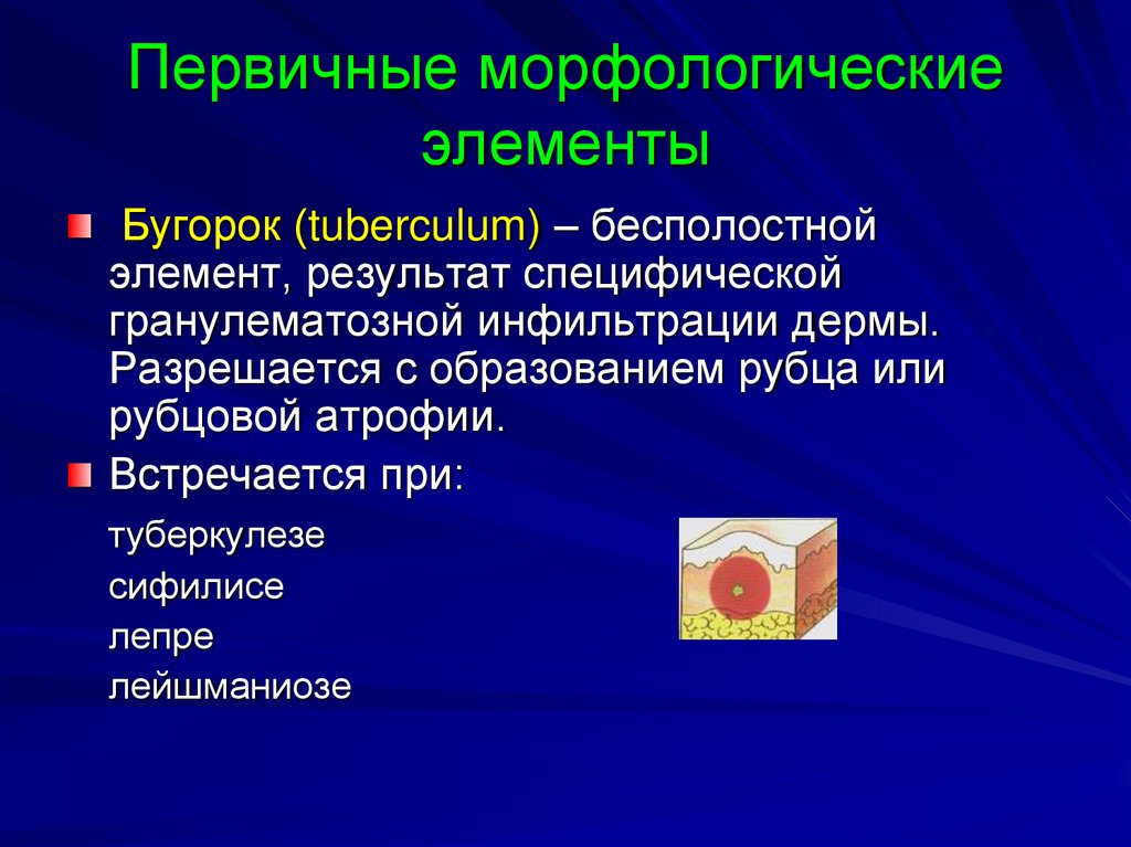 Первичные морфологические элементы