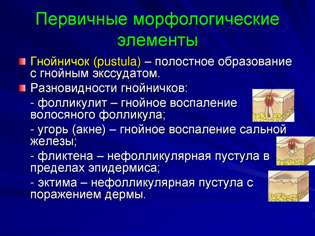 Первичные морфологические элементы