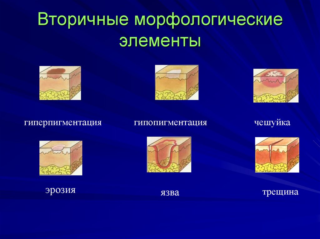 Вторичные морфологические элементы