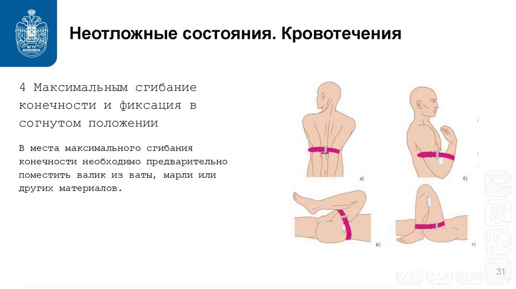 Неотложные состояния. Кровотечения