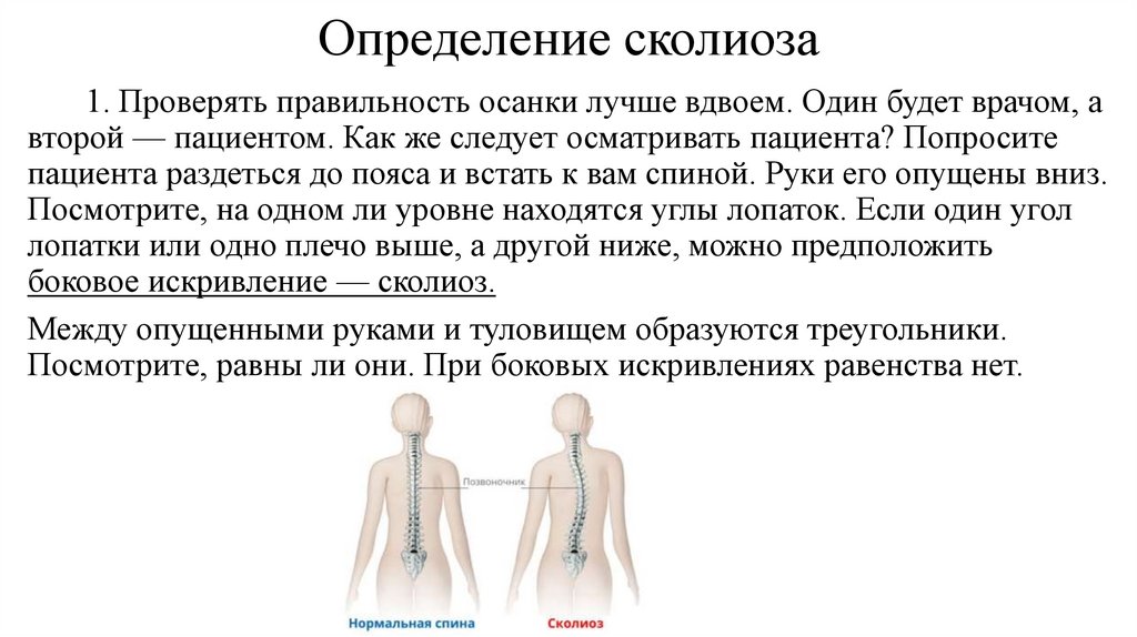 Определение сколиоза