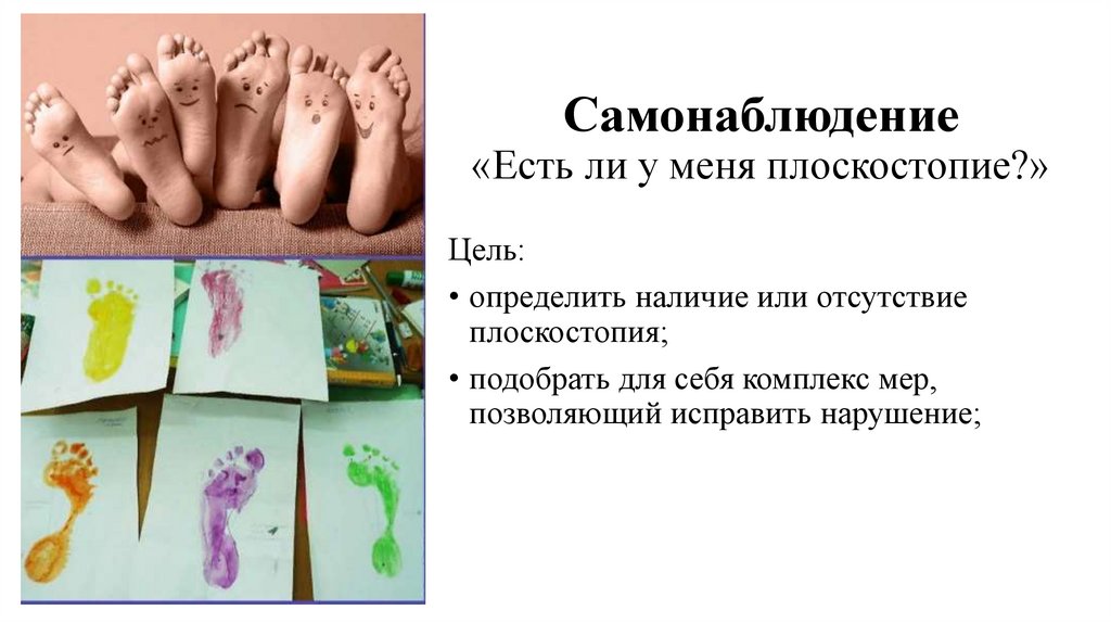 Самонаблюдение «Есть ли у меня плоскостопие?»