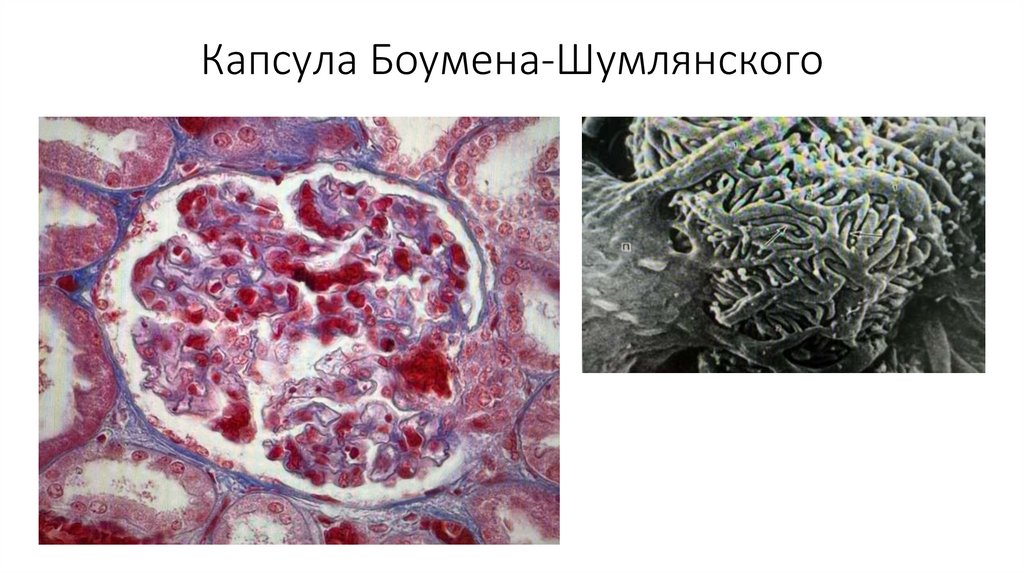 Капсула Боумена-Шумлянского